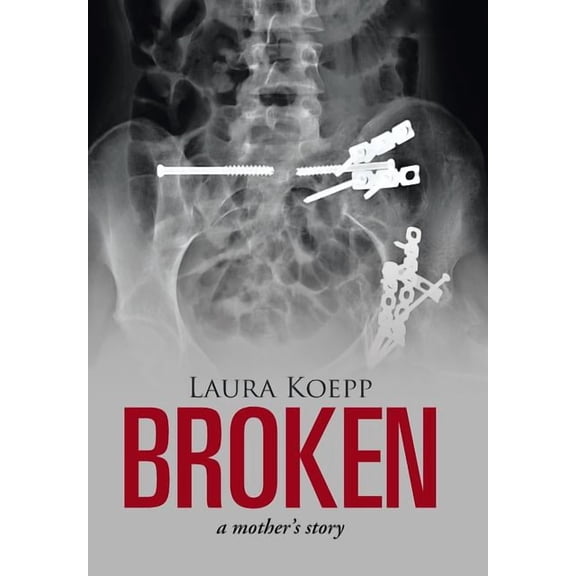 Broken: a mother's story, (Hardcover)