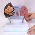 thumbnail image 4 of Smoker's Lung Model Healthy Lung Model Lung Anatomy Model With Pathological Respiratory System Disease Lungs, 4 of 5