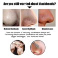 thumbnail image 5 of Blackhead Removal Nasal Mask Gently And Deeply Cleans Pores To Suck Blackheads And Acne Comes With 60 Sheets Of Tear-off Nose M, 5 of 5