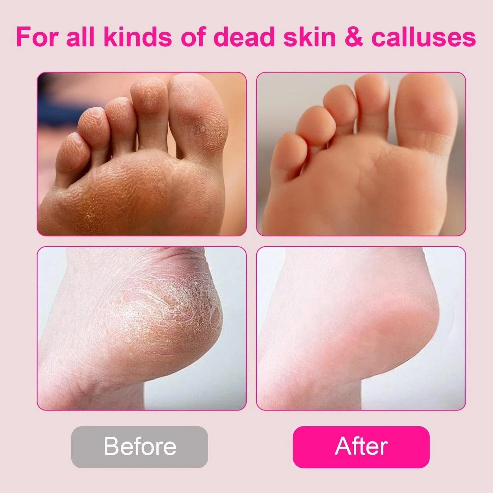 Electric Foot File, Callus Remover for Feet, Adjustable Speed Foot File