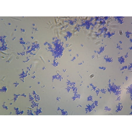 Corynebacterium Diphtheriae, Rod-Shaped; Smear; Gram-Positive by Go Science Crazy