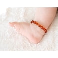 thumbnail image 3 of Pulsera de dentición Amber Crown Amber para bebés de más de 6 m, 3 of 4