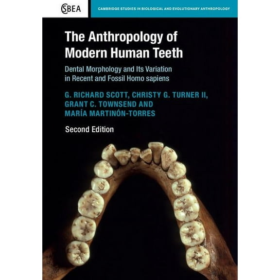 Cambridge Studies in Biological and Evol The Anthropology of Modern Human Teeth, Book 79, (Paperback)