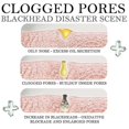 thumbnail image 5 of Jaysuing Blackhead Removal Essence Moisturizes And Tightens The Skin, Shrin |, 5 of 5