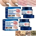 thumbnail image 1 of Crema para sabañones, crema hidratante antigrietas y anticongelación, crema reparadora para la piel de manos y pies, crema para talones secos y agrietados, 2 unidades, 1 of 5