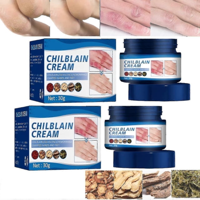 Crema para sabañones, crema hidratante antigrietas y anticongelación, crema reparadora para la piel de manos y pies, crema para talones secos y agrietados, 2 unidades