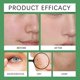 thumbnail image 3 of Instant Erase Cream, Dark Spot Remover Anti-Freckle Blemishes Cream for Face Body, Uneven Skin-Tone Serum for Daily Use, 3 of 5