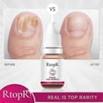 thumbnail image 5 of essential oil for nail fungus ginger 10ml, 5 of 5