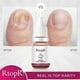 thumbnail image 5 of essential oil for nail fungus ginger 10ml, 5 of 5