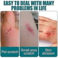 thumbnail image 4 of 3Pcs Skin Liquid Plaster Quick-dry Gel Liquid Bandage Waterproof And Breathable Wound Care Solution, 4 of 5