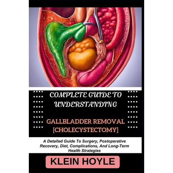 Complete Guide to Understanding Gallbladder Removal [Cholecystectomy]: A Detailed Guide To Surgery, Postoperative Recove, (Paperback)