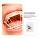 thumbnail image 3 of Paquete de 4 bandas de goma para ortodoncia, suministros dentales (amarillo claro), 3 of 3