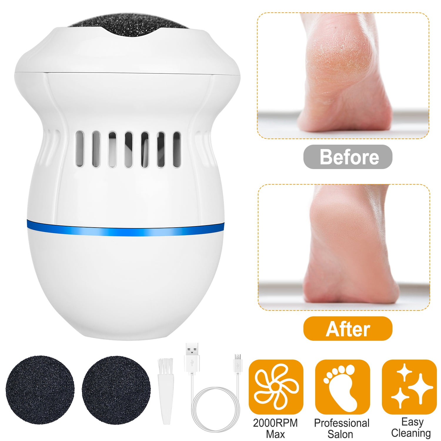 Amerteer Electric Callus Skin Remover Massager Smoother Foot Heel Cuticle Pedicure Foot Scrubber Grinder Suitable for Dry and Cracked Skin, White