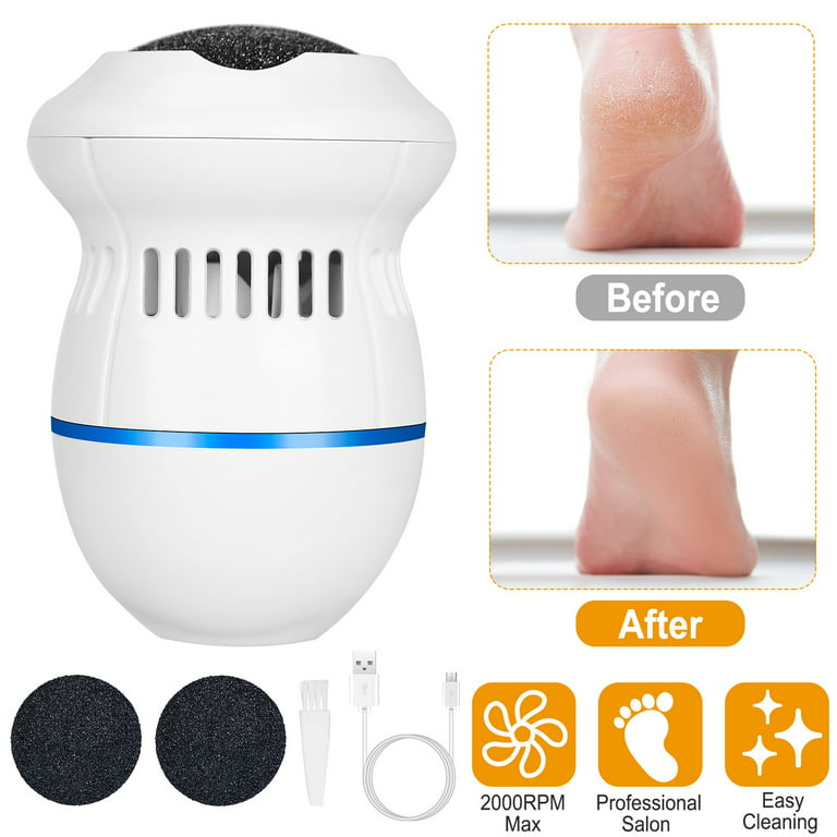 Rechargeable Electric Foot File PediVac - Callus Remover for Feet with  Built-in Vacuum Removes Dead Skin from Feet with 2000 RPMs - Electric Callus  Remover Sucks Up Shavings for Mess-Free Exfoliation