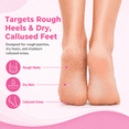 thumbnail image 2 of SAISZE Callus Remover Gel for Feet, 8 fl oz Foot Callus Remover Gel with Foot File, Callus Remover Tool for Hard Calluses and Dead Skin, 2 of 9