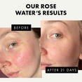 thumbnail image 3 of Tónico de agua de rosas Eclat Skincare, minimizador de poros, sin alcohol, 3 of 5