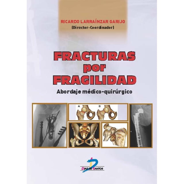 Fracturas por fragilidad Diaz de Santos 9788490520949