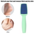 thumbnail image 2 of Foot File Removes Dead Skin Pedicure Foot Scrubber Dead Skin Callus Remover Green ABS, 2 of 7