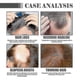 thumbnail image 2 of Hair Density Growth Essential Oil, Nourishing Hair Root Repair Perming Dry Damaged Hair Supple Hair Care Essential Oil, 2 of 5
