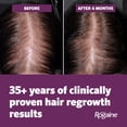 thumbnail image 6 of Women's Rogaine Hair Regrowth, 4 Mo, 2x 2.11 oz, 6 of 10