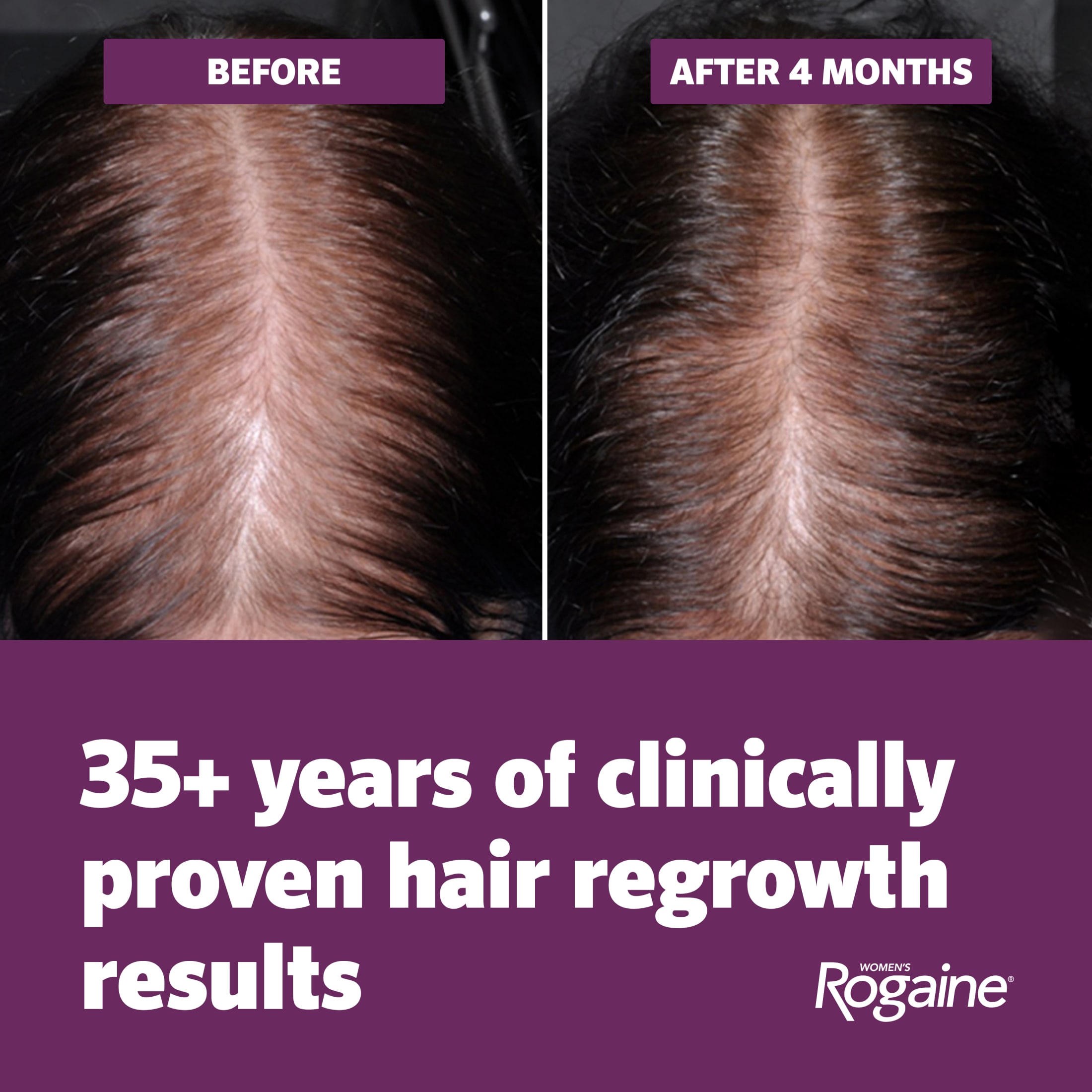 Women's Rogaine Hair Regrowth Foam 4-Month Supply photo 5