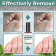 thumbnail image 3 of Corn Removal Extra Strengthen Gel Foot Callus Removal Treatment Hard Skin, 3 of 4