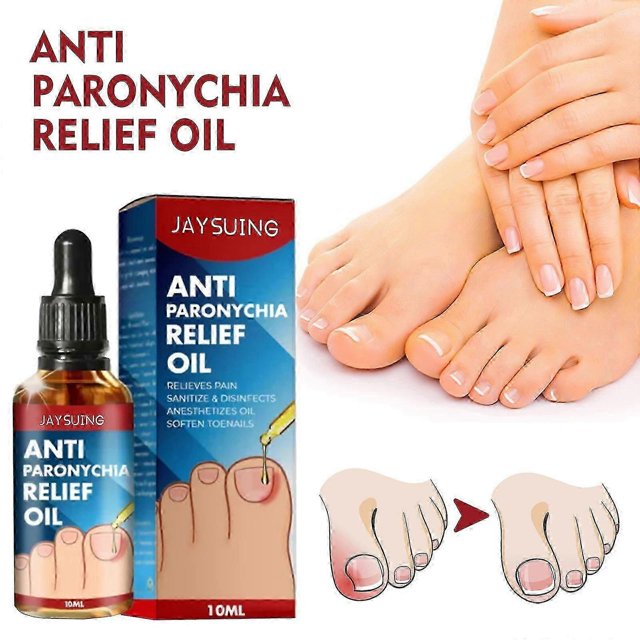 Jaysuing anti-nail groove relief oil, soft nail polish, repair ingrown toenails, thickened onychomycosis, nail groove care oil Cuticle Cream & Oil1PCS