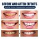 thumbnail image 4 of 90g Tooth Whitening Powder Gums Protection Cleaning Powder Oral Care Product, 4 of 5