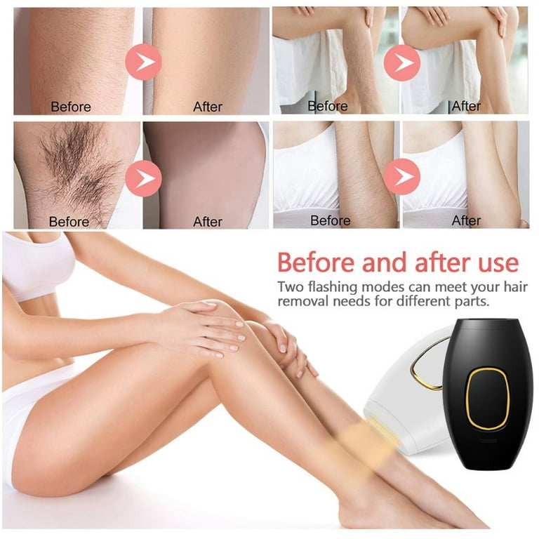 Electric Laser Hair Removal Permanent Hair Removal IPL System 500000 Light  Pulses Whole Body Epilator