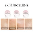 DONGGWTS 10 Pcs Face Mud Portable FaceMask Clay Clean Pore Skin Improve ...