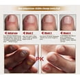 thumbnail image 3 of 1pcs 30ml Fungal Effective Nail Gel Toe Treatment Herbs Essence Oil Feet Care Nail, 3 of 4