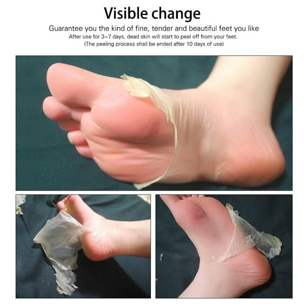 Natural dead skin remover best sale feet