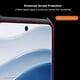 thumbnail image 5 of XUNDD For Xiaomi Redmi Note 14 Pro 5G Case Dropproof TPU Acrylic Clear Back Phone Cover, 5 of 5