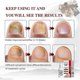 thumbnail image 4 of 15ml Fungi Nail Treatment Liquid Fast-Acting Nail Repair Strengthening Liquid Nails Care Supplies, 4 of 5