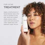 Jan Marini Skin Research Benzoyl Peroxide 2.5% Acne Treatment Wash - 8 Fl Oz
