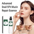 thumbnail image 1 of Pgyong Liquidation! Solution d'Escargot Solution Hydratante 100ml, 1 of 9