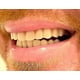 thumbnail image 4 of Instant Smile Comfort Fit Flex Teeth - Upper and Lower Matching Set Natural Shade! Fix Your Smile at Home Within Minutes!, 4 of 4