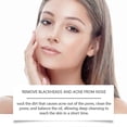 thumbnail image 3 of Blackhead Remover Pore Strips, Black Head Remover for Face, Natural Bamboo Charcoal Nose Strips for Pore Cleaner,Oil Blackheads &, 3 of 5