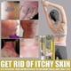 thumbnail image 5 of Skin Repair Cream Versicolor Sweat Spot Topical Application Ointment Skin Anti-itch, 5 of 5