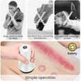 thumbnail image 2 of Electric suction cup-White, gua sha massager, cellublue massage anti-cellulite suction cup, promote blood circulation, Relax and relieve body, neck, legs, waist, back pain, 2 of 5