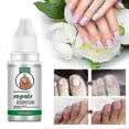 thumbnail image 4 of Nail Fungus Treat Onychomycosis Toe Care Nail Repair -, 4 of 5