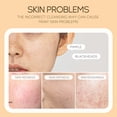 thumbnail image 4 of Limpiador facial, Limpiador facial Mouss limpiadora Limpieza facial Limpieza de poros 120 ml Limpieza facial, 4 of 5