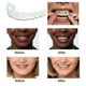 thumbnail image 3 of A Pair Upper & Lower High Quality Denture Instant Smile Comfort Fit Flex Cosmetic Teeth Denture Teeth Top Cosmetic Veneer High Quality Bdliv, 3 of 5