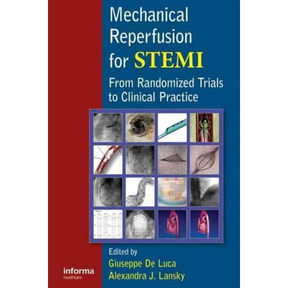 Mechanical Reperfusion for STEMI: From Randomized Trials to Clinical Practice (Hardcover)