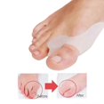 thumbnail image 3 of 3pcs Bunion Corrector For Women, Bunion Corrector Big Toe With Bunion Pads Toe Separators, 3 of 4