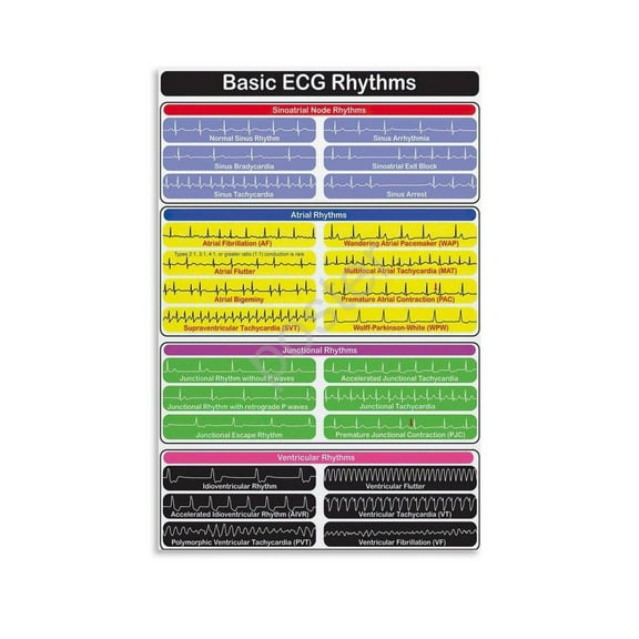 EKG Knowledge Poster Basic ECG Heart Rhythms Hospital Wall Art Poster (5) Canvas Painting Posters And Prints Wall Art for Living Room Bedroom Decor