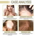 thumbnail image 4 of Sérum para el crecimiento del cabello 60 ml para cabello fino y tratamiento anticaída con nutrición profunda., 4 of 5