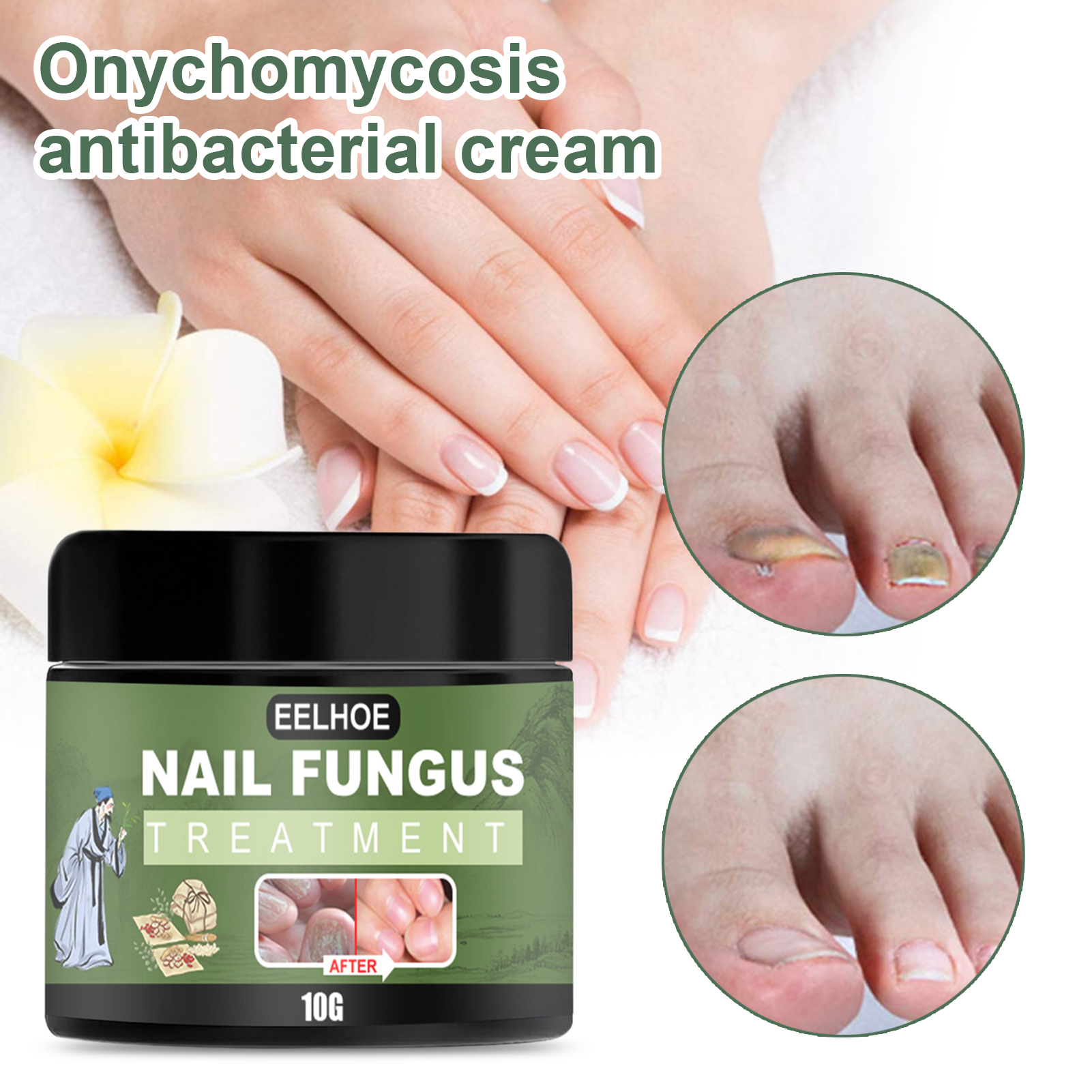 Farfi 10203050g Nail Fungal Cream Anti Infection Kuwait Ubuy