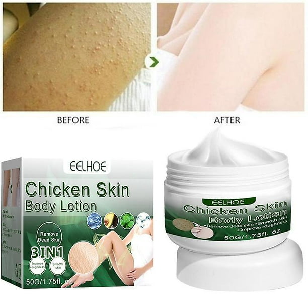 Skin Repairing Cream Body Moisturizing Whiten Serum Skin Softening Cream Chicken Skin Remove Treatment Winter Relieve Dry Skin Walmart