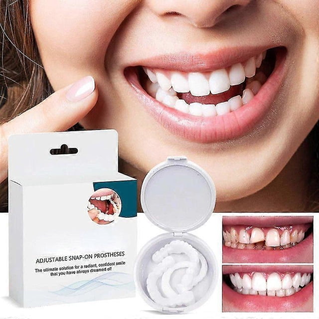 Adjustable Snap On Prothesens, Adjustable Snap On Denture, Silicone Whitening Denture Braces, Cover